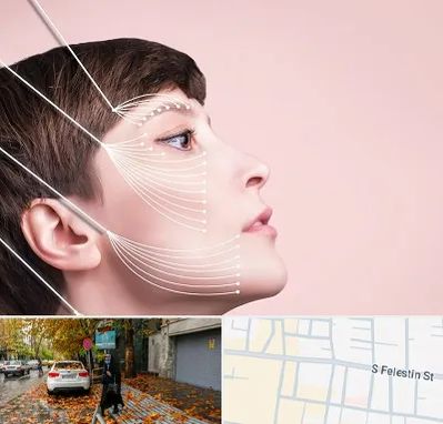 اندولیفت پیشانی در خیابان فلسطین