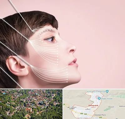 اندولیفت پیشانی در دماوند