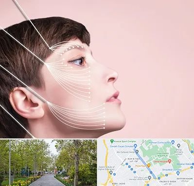 اندولیفت پیشانی در قدوسی غربی شیراز