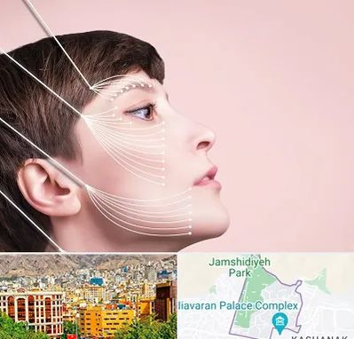 اندولیفت پیشانی در نیاوران 