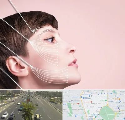 اندولیفت پیشانی در منطقه 17 تهران 