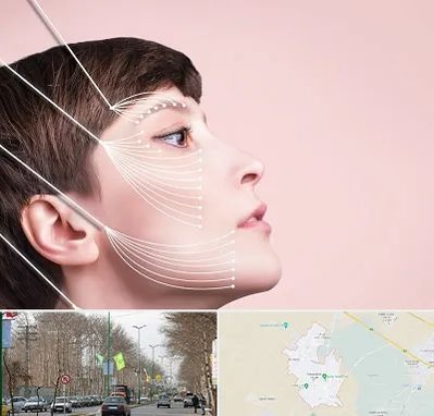 اندولیفت پیشانی در نظرآباد کرج 