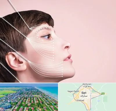 اندولیفت پیشانی در ساری