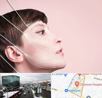 اندولیفت پیشانی در اقدسیه 