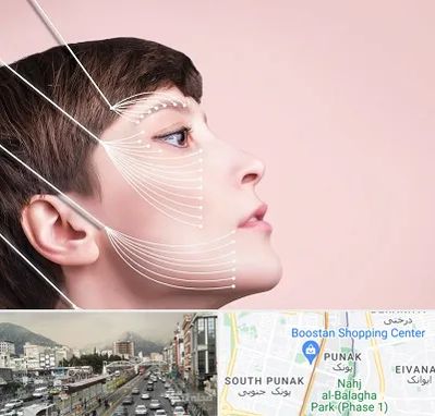 اندولیفت پیشانی در پونک 