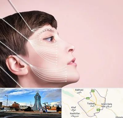 اندولیفت پیشانی در تایباد