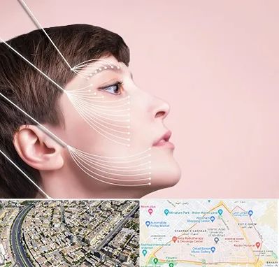 اندولیفت پیشانی در شهرک غرب مشهد