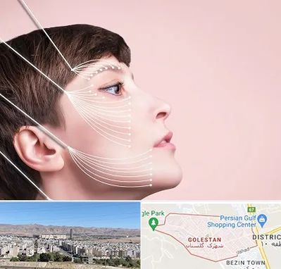 اندولیفت پیشانی در شهرک گلستان شیراز