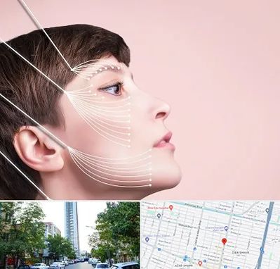 اندولیفت پیشانی در امامت مشهد