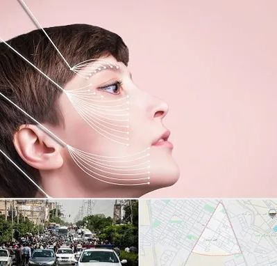 اندولیفت پیشانی در سیدی مشهد