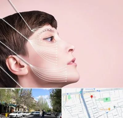 اندولیفت پیشانی در کوی فیروز تبریز