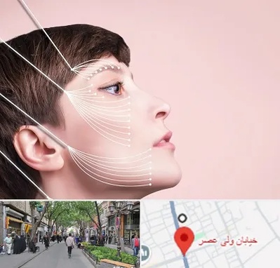 اندولیفت پیشانی در ولیعصر شهریار