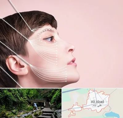 اندولیفت پیشانی در علی آباد کتول