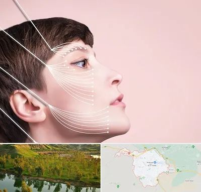 اندولیفت پیشانی در بهبهان