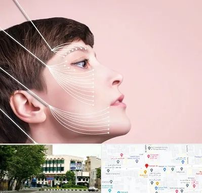 اندولیفت پیشانی در طالقانی 