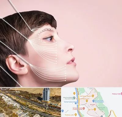 اندولیفت پیشانی در خیابان نیایش شیراز