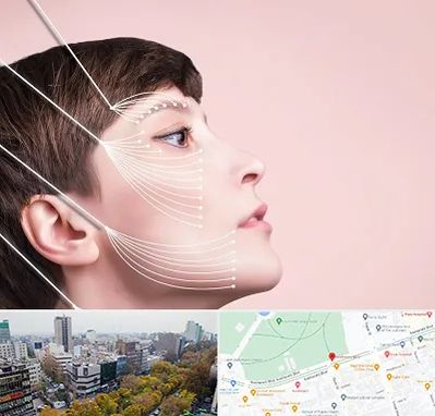 اندولیفت پیشانی در بلوار کشاورز 