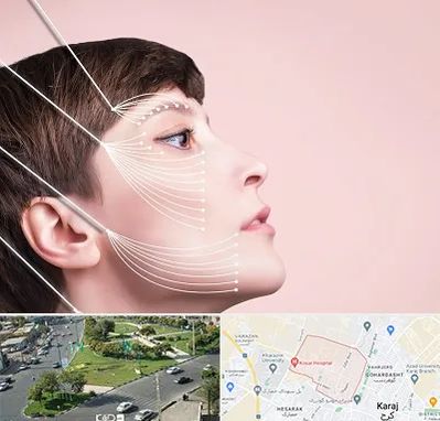 اندولیفت پیشانی در شاهین ویلا کرج