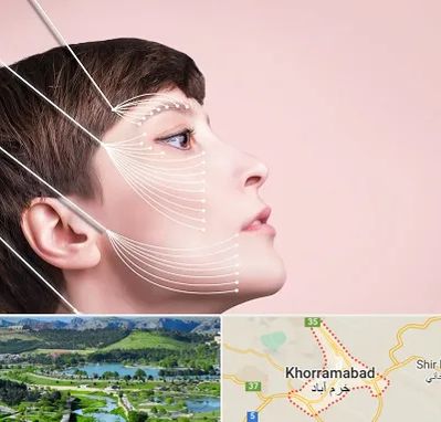 اندولیفت پیشانی در خرم آباد