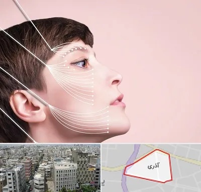 اندولیفت پیشانی در آذری