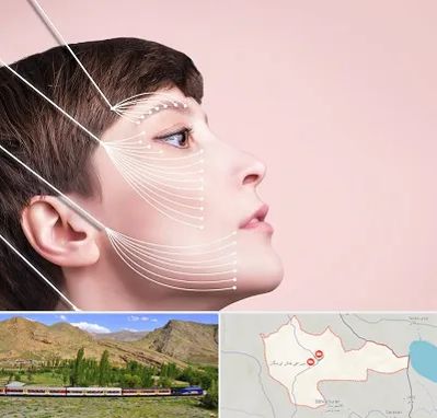 اندولیفت پیشانی در خاش