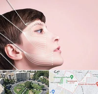 اندولیفت پیشانی در جهانشهر کرج 