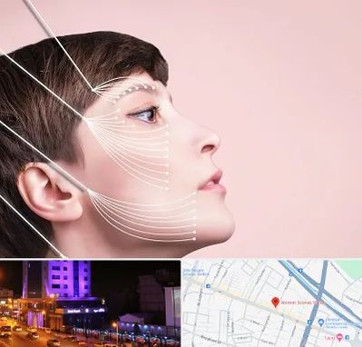 اندولیفت پیشانی در آبرسان تبریز