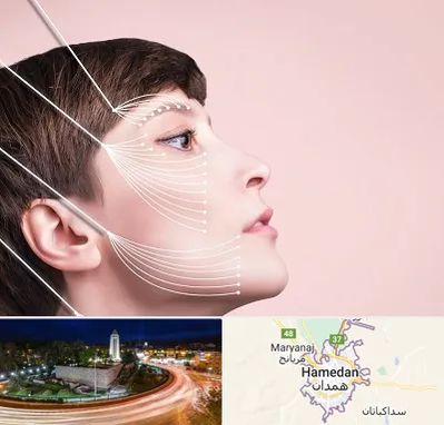 اندولیفت پیشانی در همدان