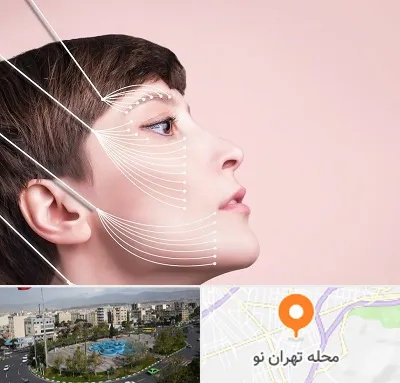 اندولیفت پیشانی در تهران نو
