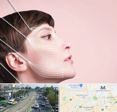 اندولیفت پیشانی در جنوب تهران 