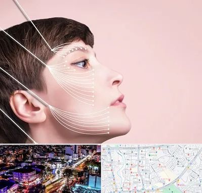 اندولیفت پیشانی در منظریه رشت