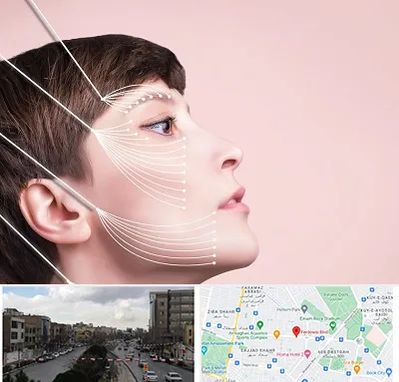 اندولیفت پیشانی در بلوار فردوسی مشهد 