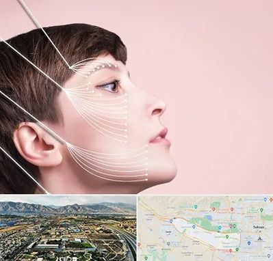 اندولیفت پیشانی در منطقه 21 تهران 