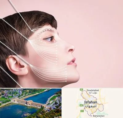 اندولیفت پیشانی در اصفهان
