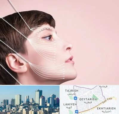 اندولیفت پیشانی در قیطریه 