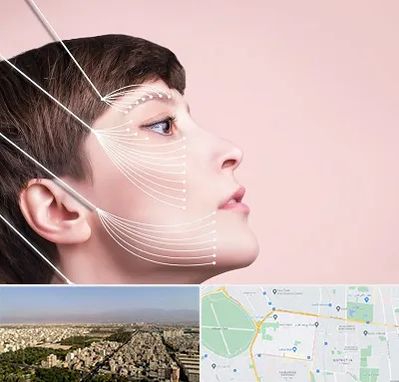 اندولیفت پیشانی در نازی آباد 