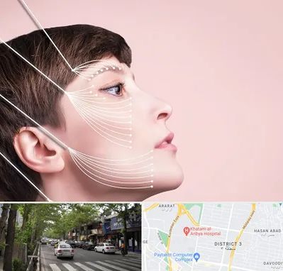 اندولیفت پیشانی در ظفر 