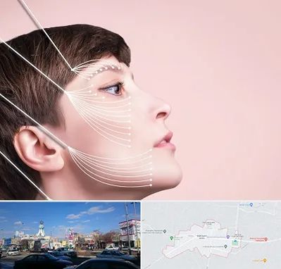 اندولیفت پیشانی در ماهدشت کرج 