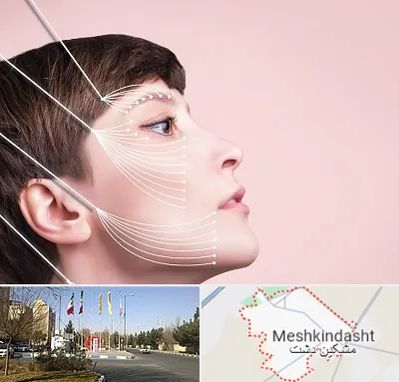 اندولیفت پیشانی در مشکین دشت