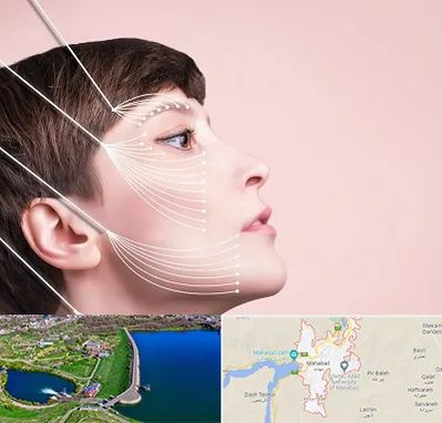 اندولیفت پیشانی در مهاباد