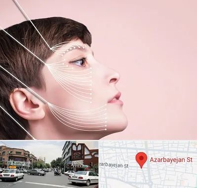 اندولیفت پیشانی در خیابان آذربایجان