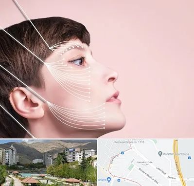 اندولیفت پیشانی در شهر زیبا 