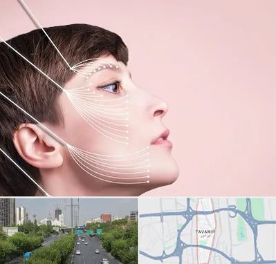 اندولیفت پیشانی در توانیر