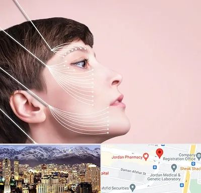 اندولیفت پیشانی در جردن 