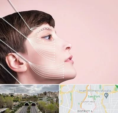 اندولیفت پیشانی در یوسف آباد 