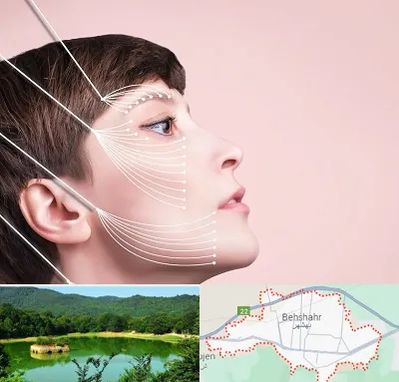 اندولیفت پیشانی در بهشهر