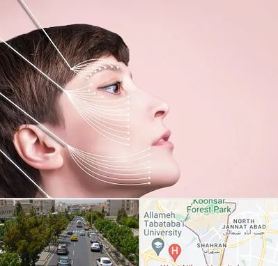 اندولیفت پیشانی در شهران 