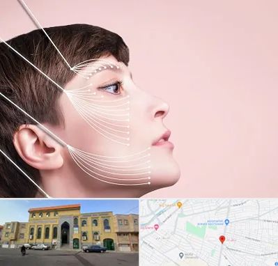 اندولیفت پیشانی در زنبیل آباد قم