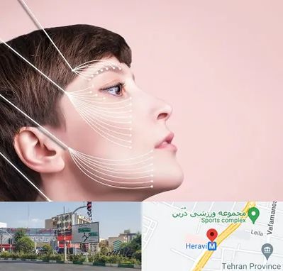 اندولیفت پیشانی در هروی 