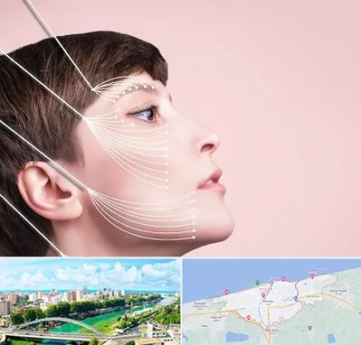 اندولیفت پیشانی در بابلسر